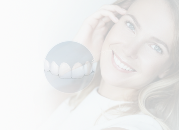 Shenzhen veneers price